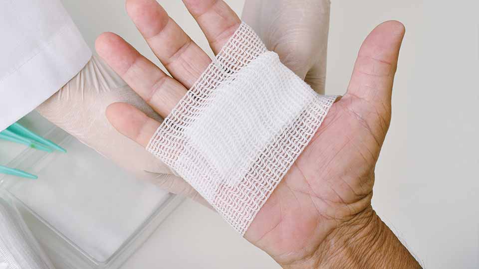 Antimicrobial effects of bacterial binding to a dialkylcarbamoyl chloride-coated wound dressing: an in vitro study